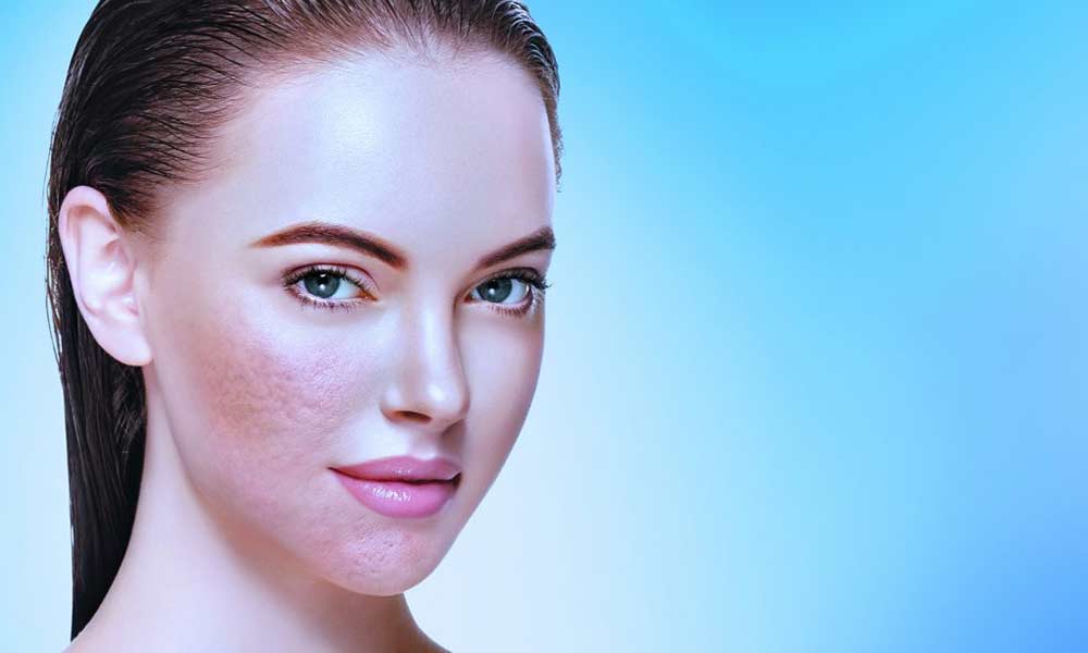 Open skin pores